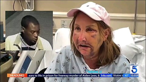 Woman who was savagely attacked by thug speaks out.