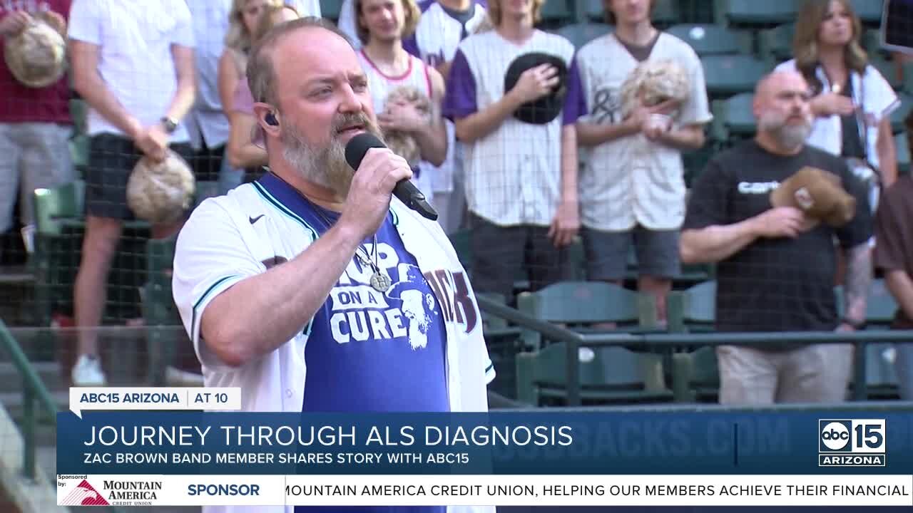 Zac Brown Band founding member shares ALS diagnosis