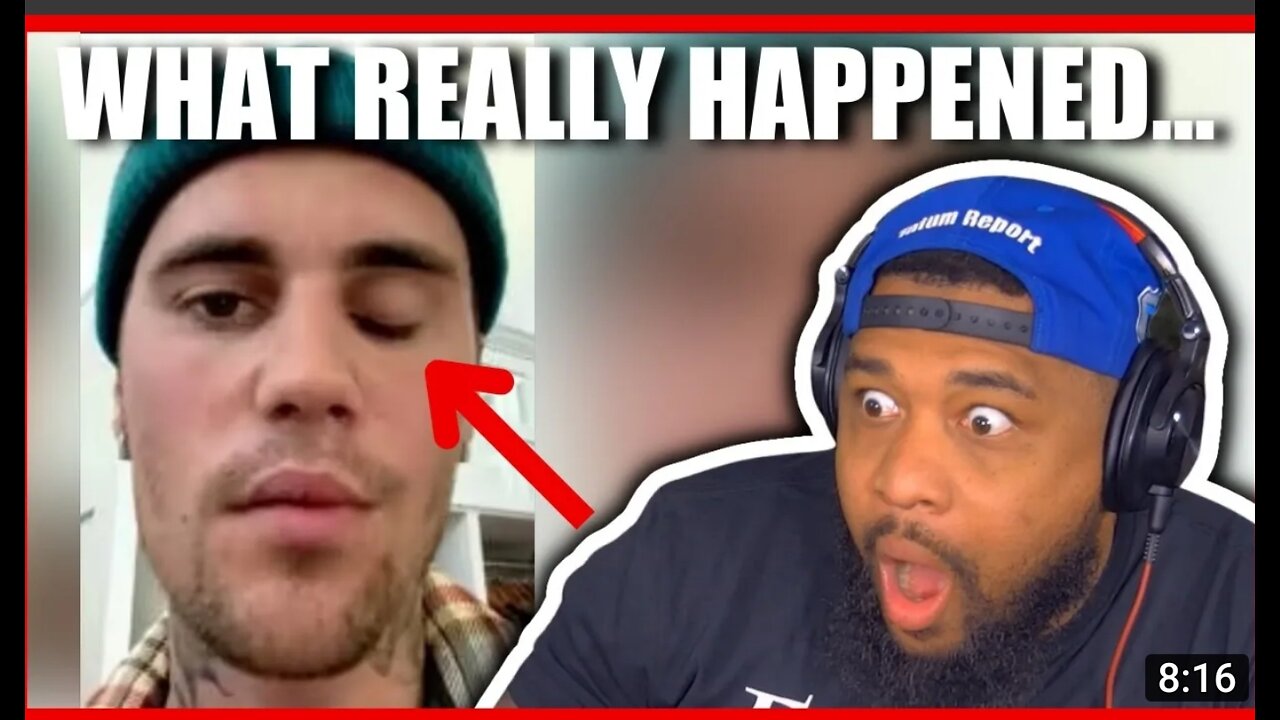 The Truth About JUSTIN BIEBERS FACE!