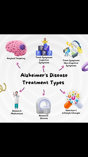 Alzheimer's Disease - Treatment Types