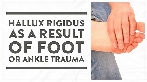 Hallux rigidus as a result of foot or ankle trauma