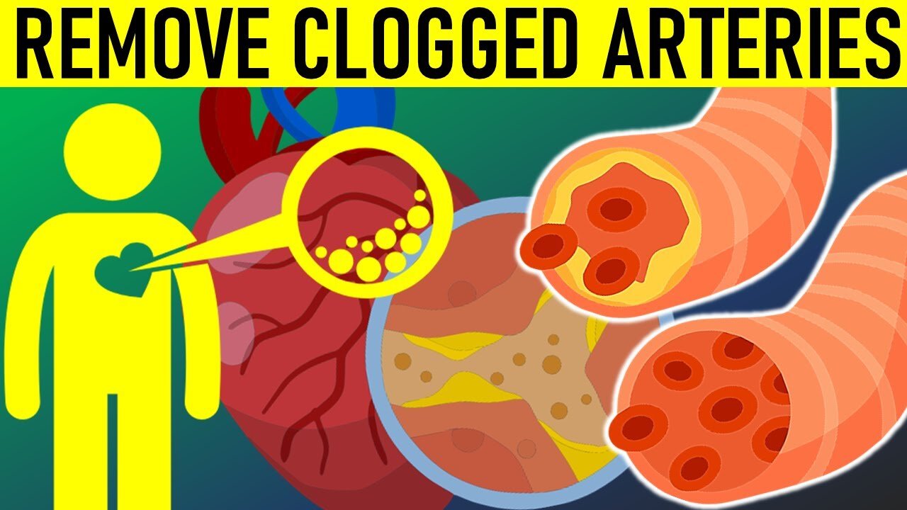 Surprising Ways to Unclog Your Arteries - You've Got to See These 11 Foods!