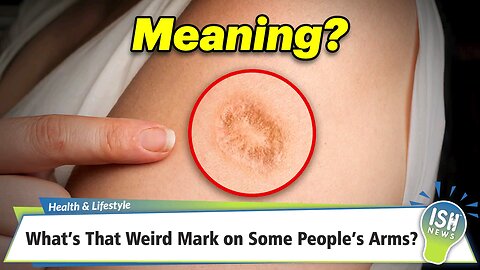 How people are being vaccinated in small pox Vaccine