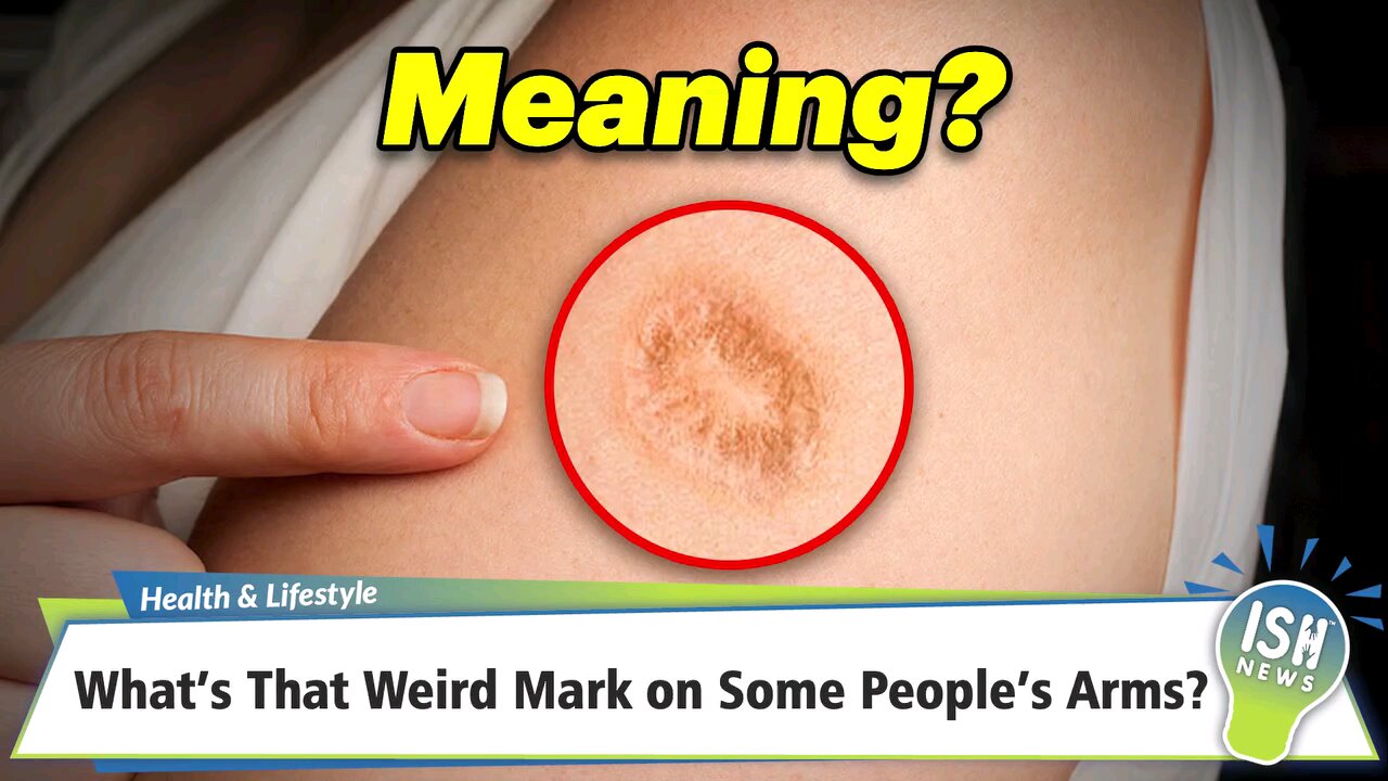 How people are being vaccinated in small pox Vaccine