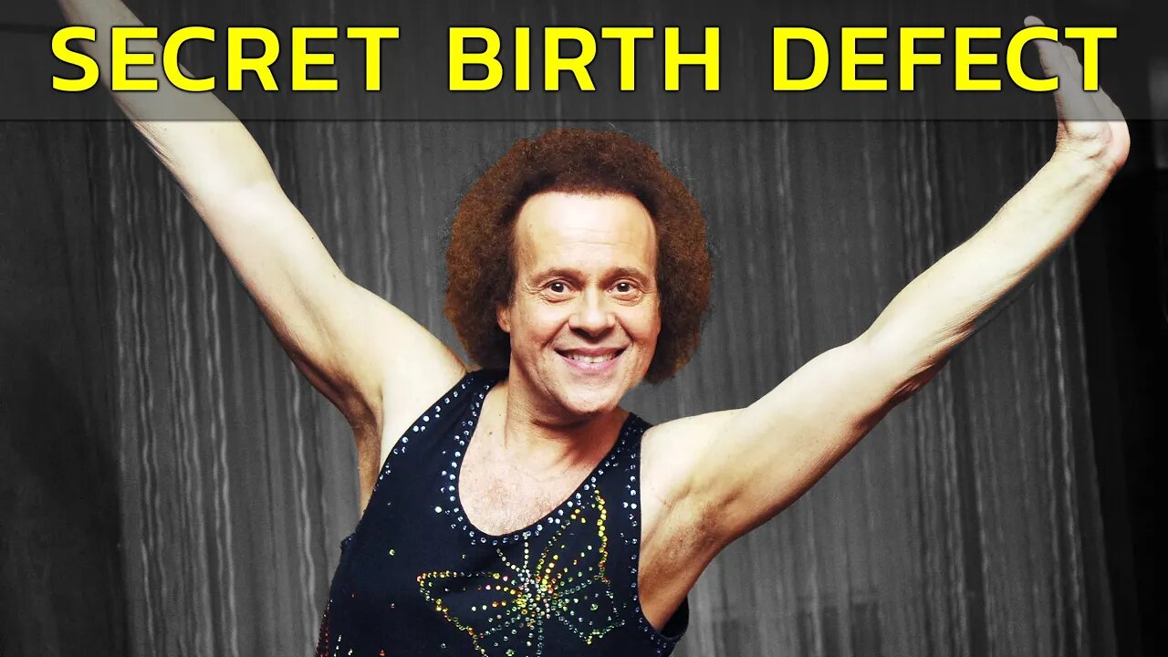 THE SECRET BIRTH DEFECT OF RICHARD SIMMONS