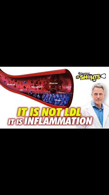 #SHORTS It is not LDL it is inflammation