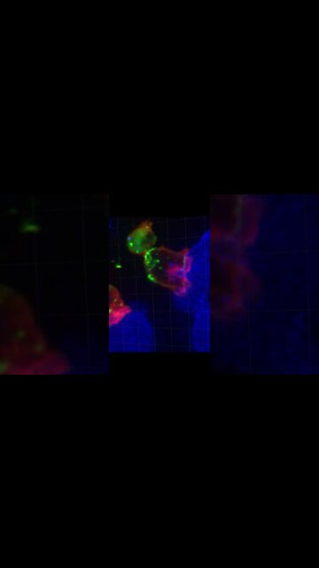 #38 Tratamento que cura câncer usa as células do próprio paciente