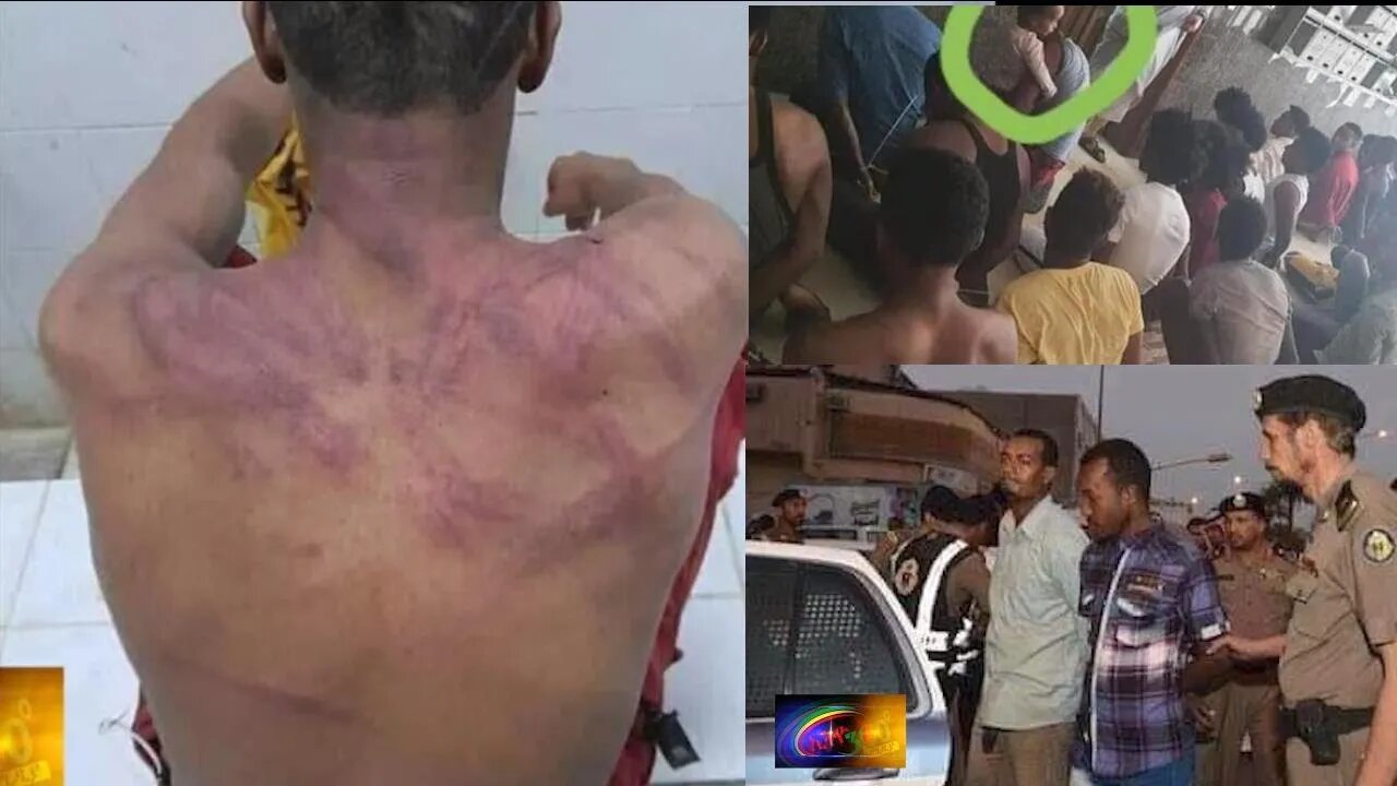 Ethio 360 Special Program "በሳውዲ ማቆሚያ ያጣው የኢትዮጵያውያን ሰቆቃ Monday June 14, 2021