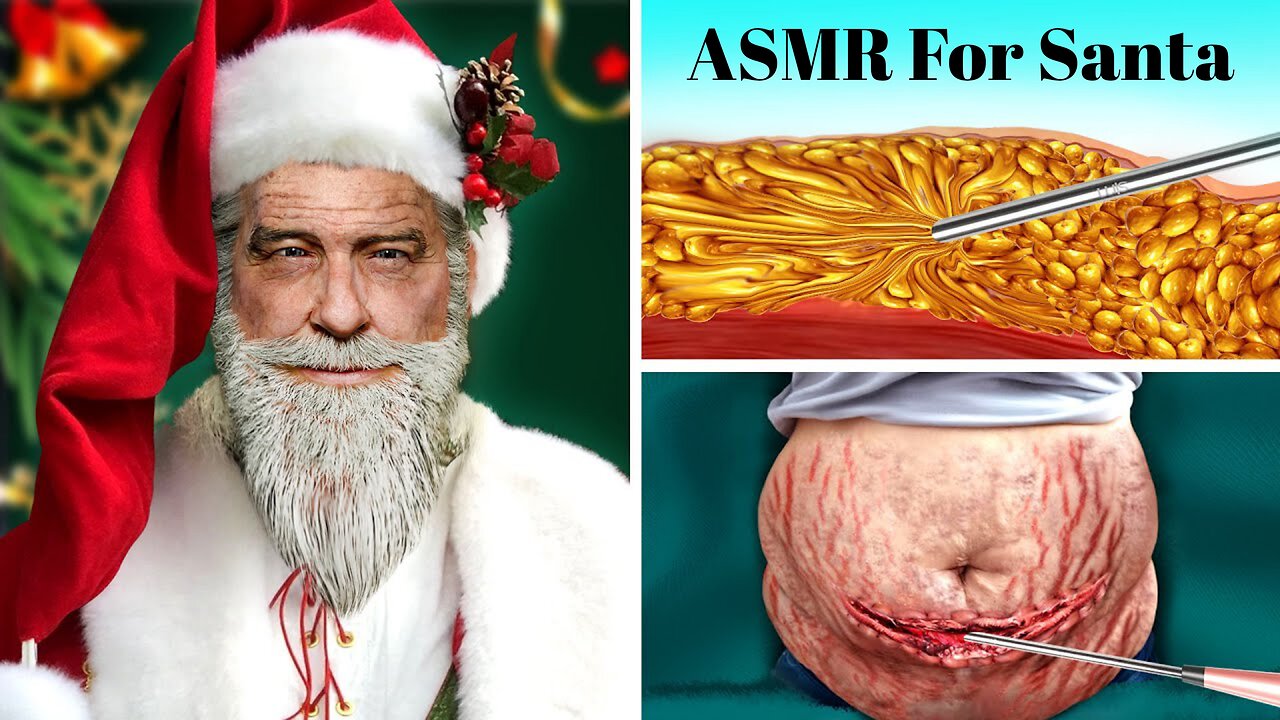 ASMR Liposuction Surgery For Santa Claus | Most Satisfying Special Christmas