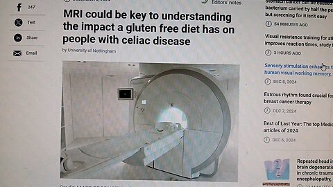 Celiac Disease MRI could be key to understanding the impact a gluten free diet has on people