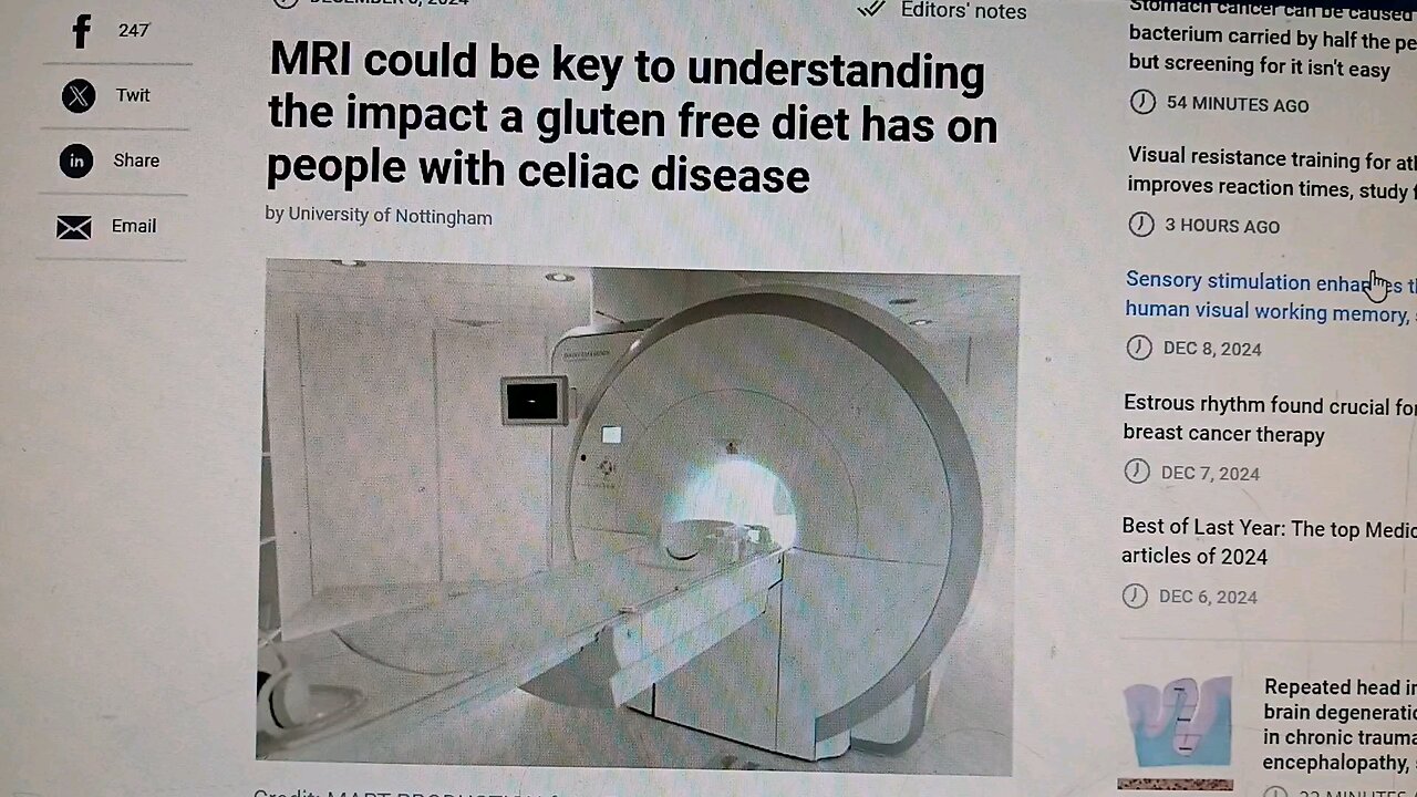 Celiac Disease MRI could be key to understanding the impact a gluten free diet has on people