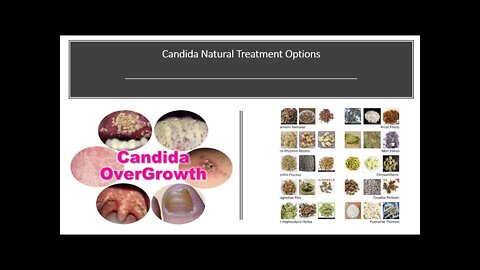 Candida Natural Treatment Options with Herbs & Supplements