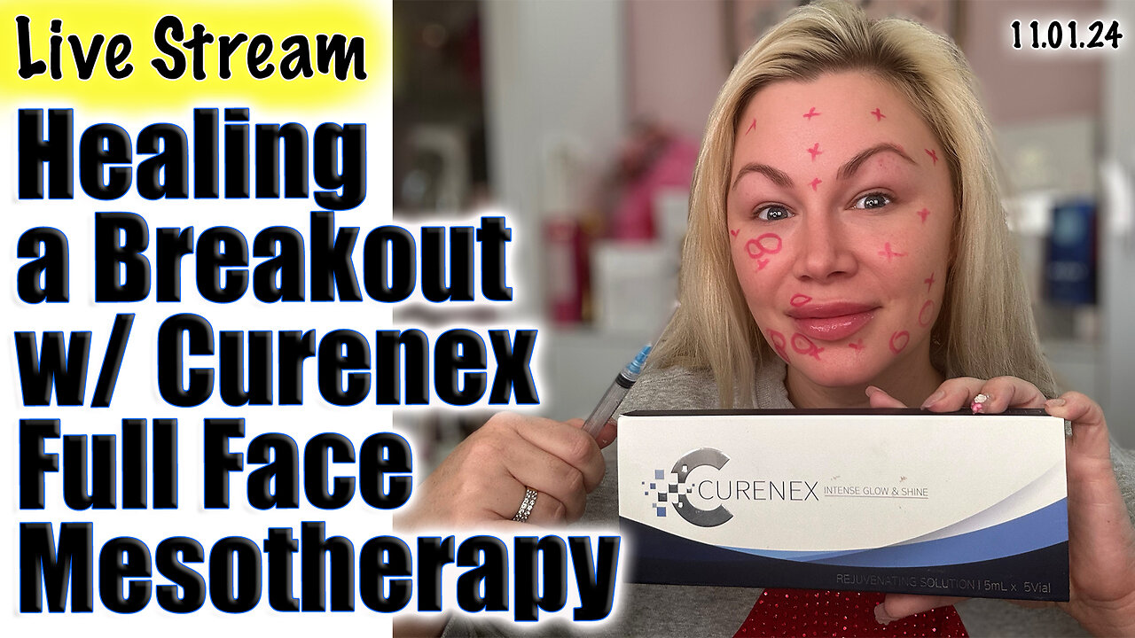 Live Healing a Breakout w/ Curenex Full Face Mesotherapy, AceCosm.com | code Jessica10 saves money