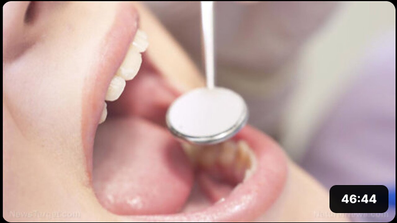 How root canals, mercury fillings can endanger your health