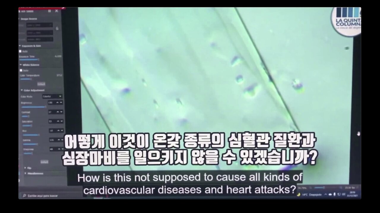 주사약물 안에 들어간 물체