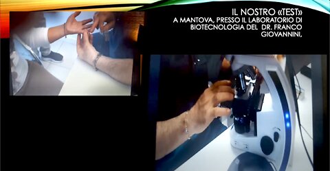 Ecco gli esami al microscopio del sangue delle persone vaccinate, agghiacciante!