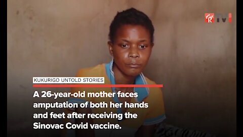 26yo woman faces amputation of her hands and feet after she reacted to the chinese Covid "vaccine"