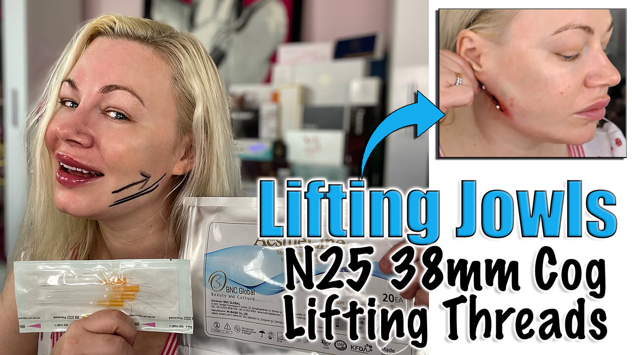 Lifting Jowls with N25 38mm Cog Lifting Threads from Acecosm.com | Code Jessica10 Saves you Money!