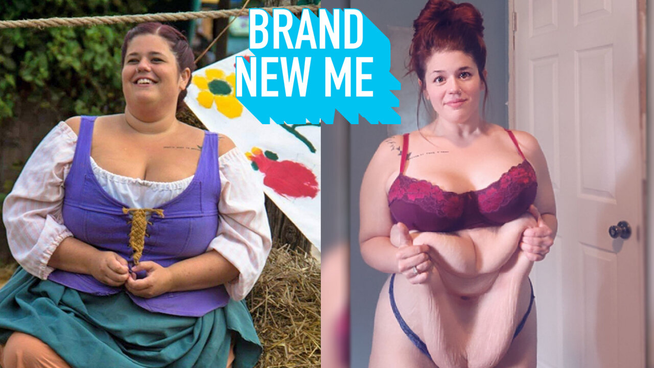 My 200lb Weight Loss Left Me With 15lbs Of Excess Skin | BRAND NEW ME