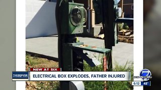 Electrical box explodes, father injured