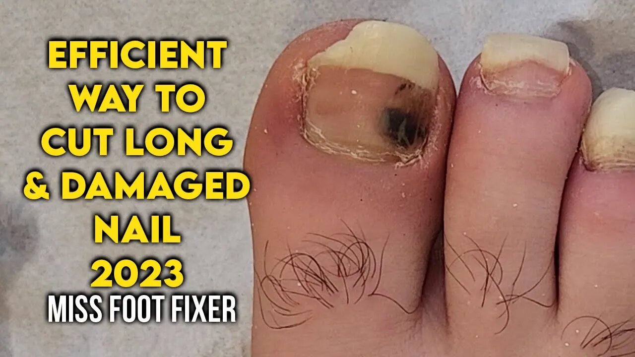 "Efficient Techniques for Foot Nail Cutting and Cleaning" By famous feet Specialist miss foot fixer