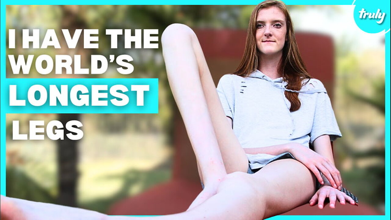 I’m 16 & Have The World’s Longest Legs | BORN DIFFERENT