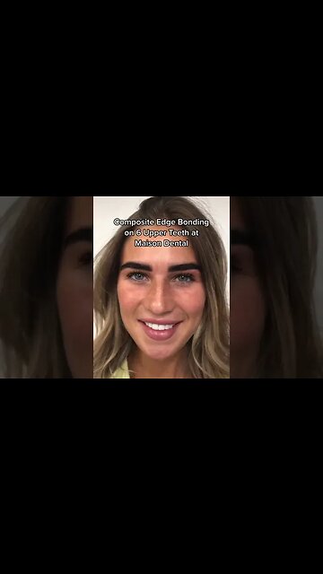 Dental And Teeth Hygiene