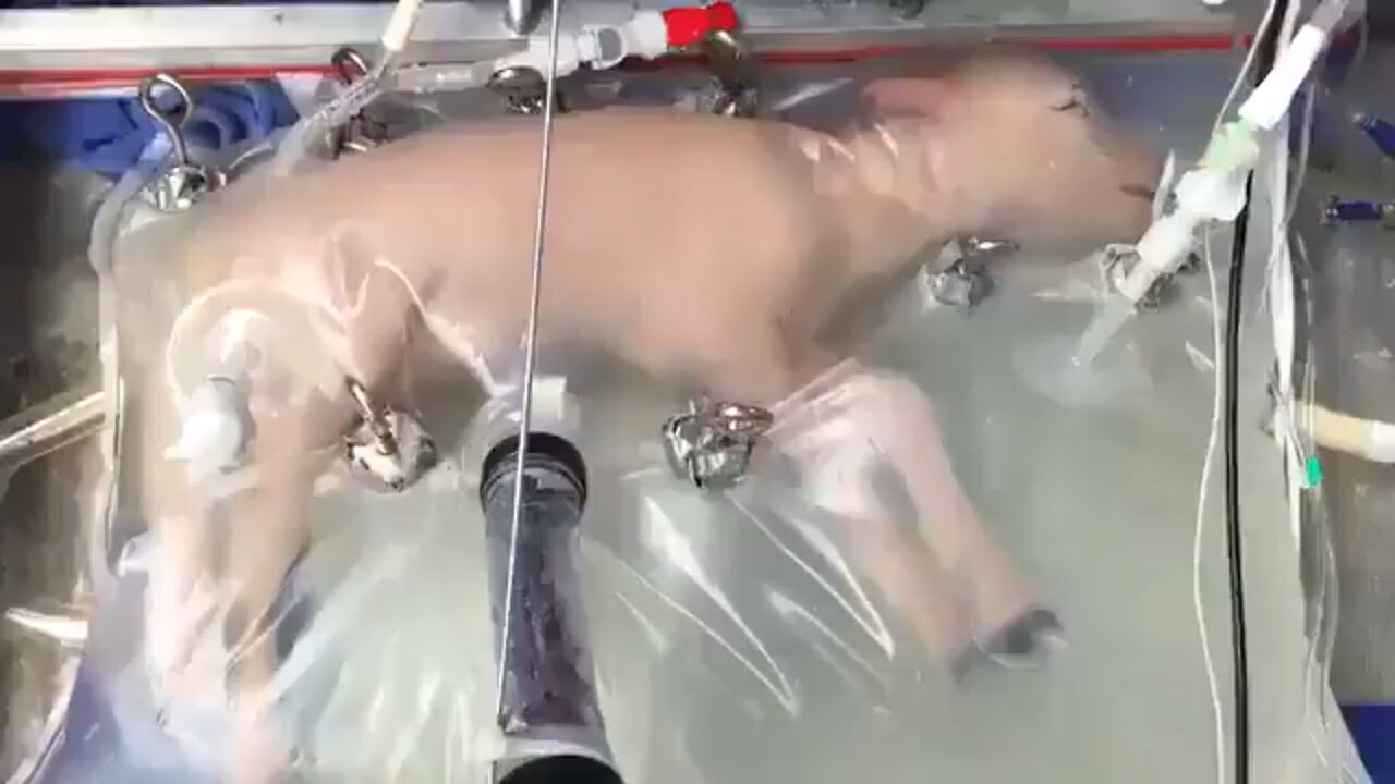 This is the artificial womb successfully grew lamb fetuses and could help prematurely born babies.