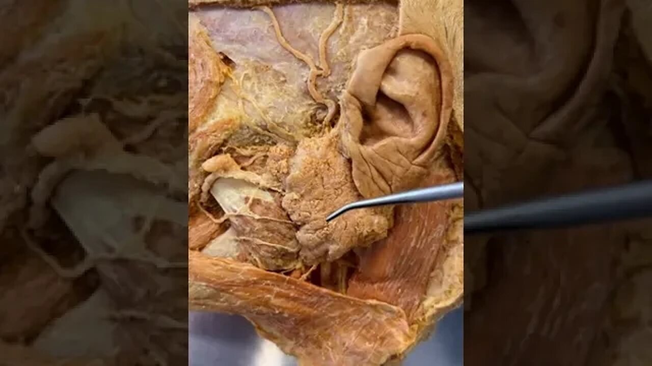 The Inside of a Real Cheek