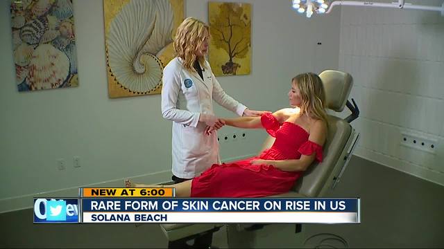 Dermatologists warn of Merkel Cell Carcinoma during Skin Cancer Awareness Month