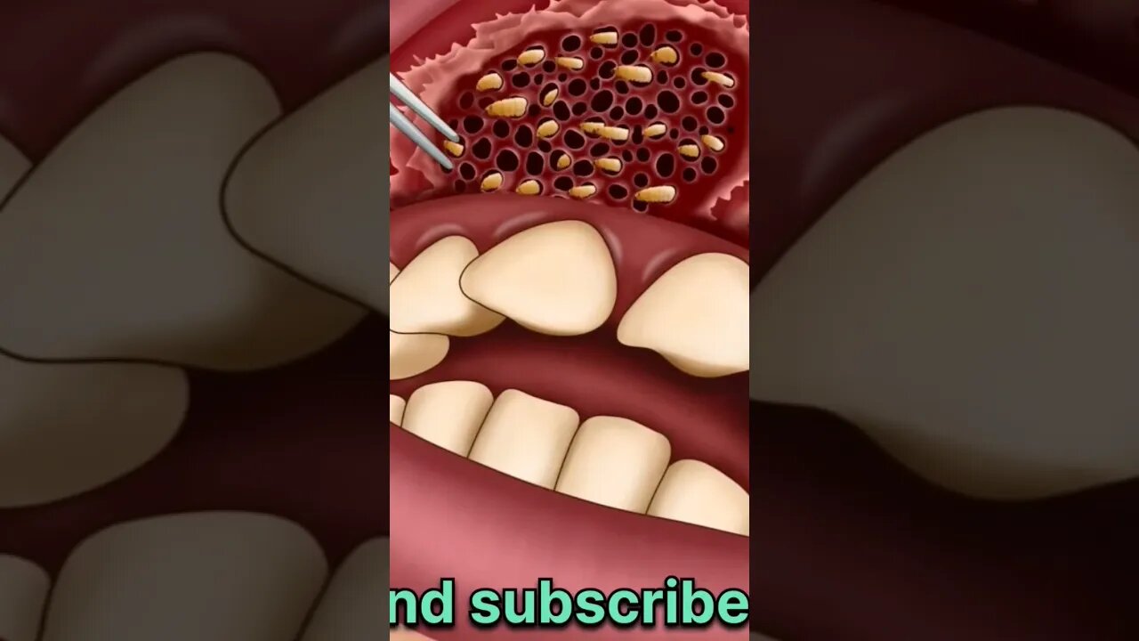 #asmr #homeless #funny #shortsvideo #video #funnyvideo #anime #@uttam6361 #manojdey #skincare