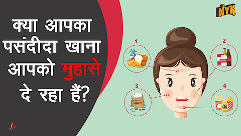 4 surprising foods जो आपको pimples और मुहा से दे सकते है