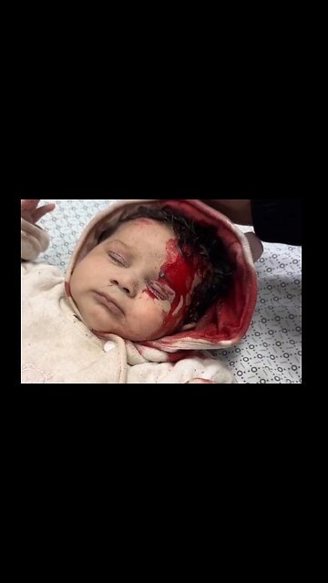 Baby Severely Injured by Occupation Forces