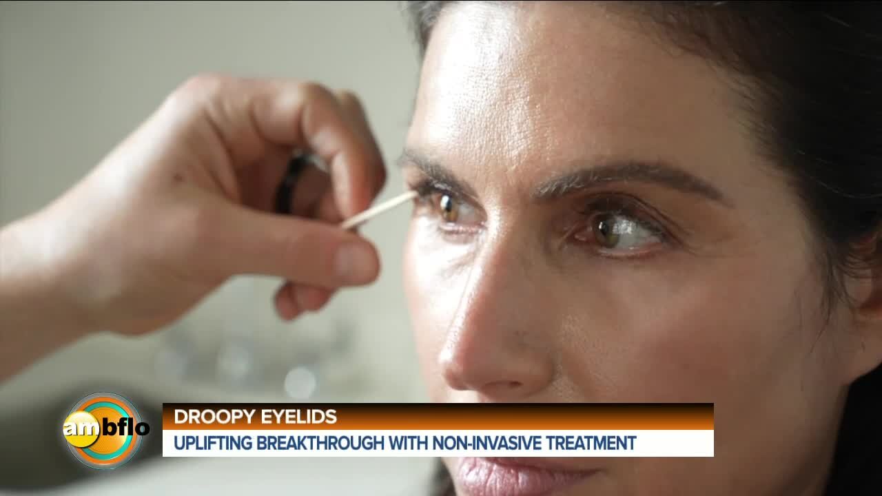 DROOPY EYES - NON INVASIVE TREATMENT