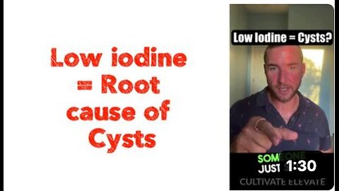 Low iodine = Root cause of Cysts