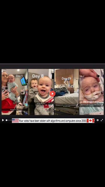 A VACCINATED BABY ...BEFORE AND AFTER