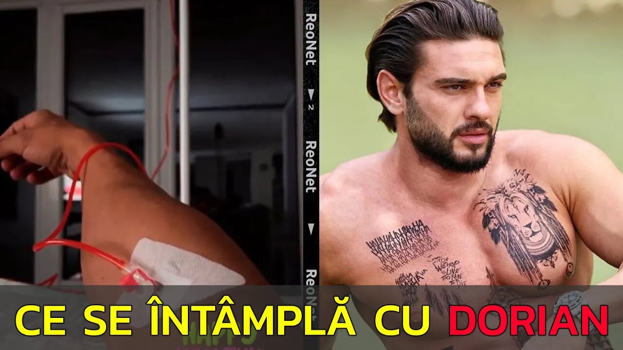 DORIAN POPA CU PERFUZIA LA MÂNĂ! CE A PĂȚIT DORIAN