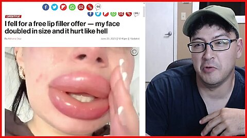 GIRL FALLS FOR FREE LIP FILLER, BUT IT WENT BAD