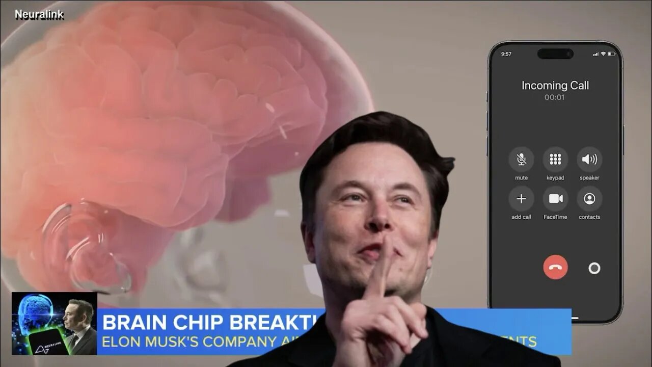 SHARE THIS! 1ST HUMAN UNDERGOES NEURALINK BRAIN CHIP TRANSPLANT! HOWEVER THIS ISN'T REALLY THE 1ST!