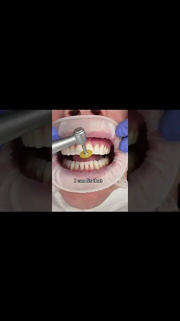 Dental And Teeth Hygiene
