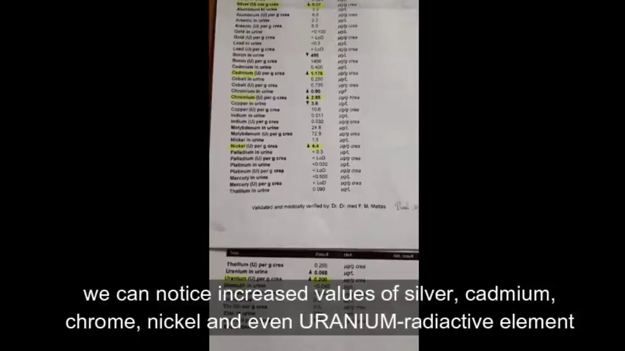 Radioactive URANIUM and other heavy metals in vaccines