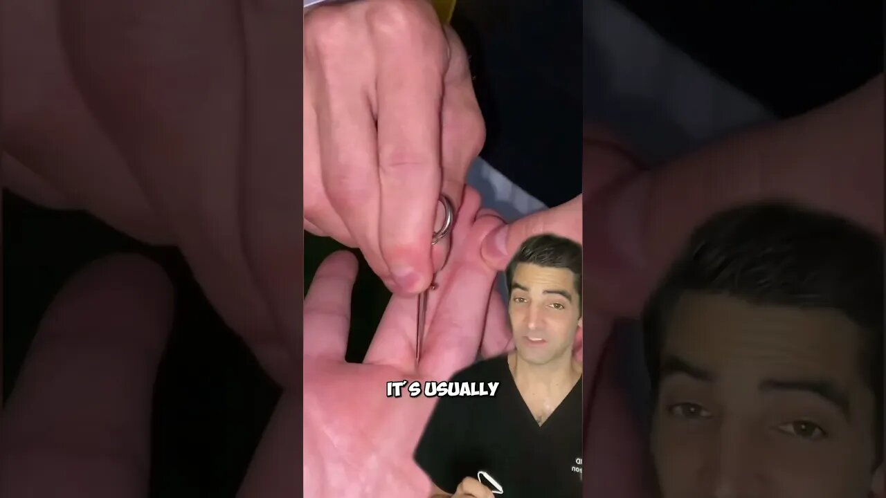 Fingers Stuck Together