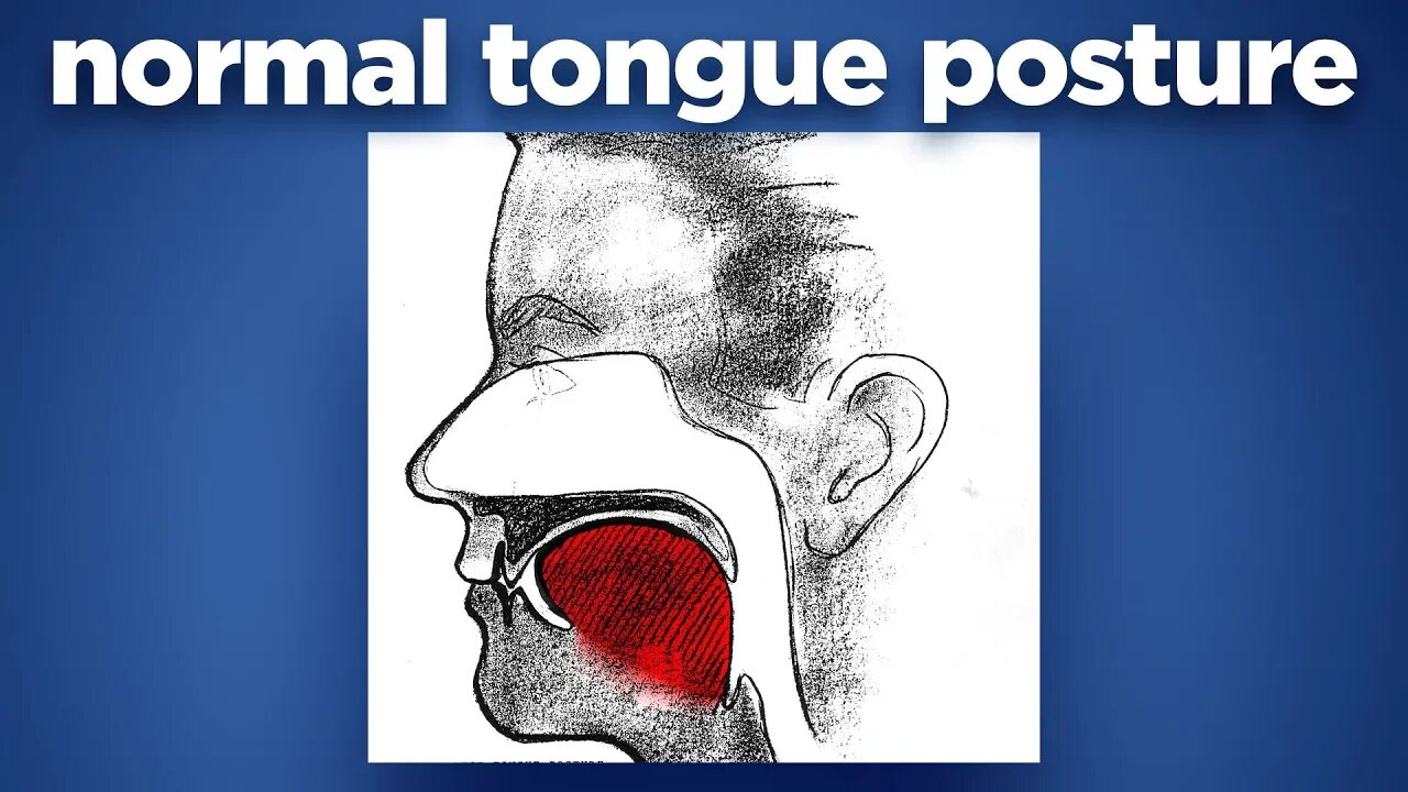 Normal Tongue Posture by Prof John Mew