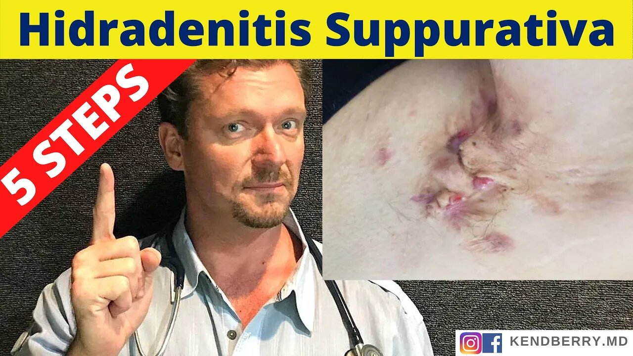 HYDRADENITIS SUPPURATIVA (5 Steps to Reverse HS)