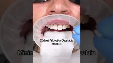 Dental And Teeth Hygiene