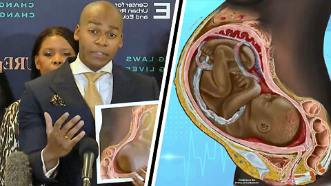 Abortion Targets Black Babies! - Jonathan Alexandre - LCA