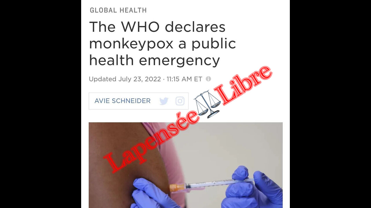 MONKEY🐒POX