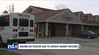 Couple sues Bay Village day care over son's injuries