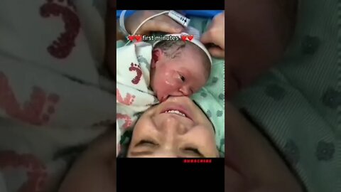 new Born baby #shorts #shortsvideo #voiceofkanij