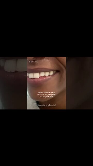 Dental And Teeth Hygiene